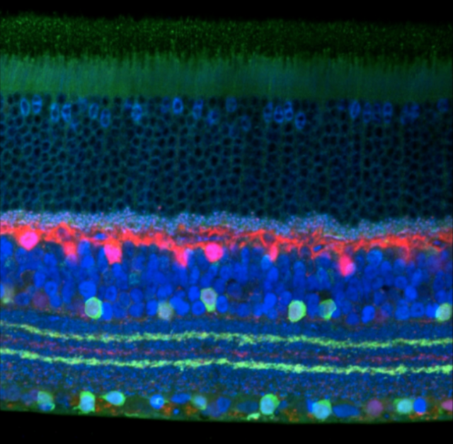 Analyzing Genes Involved in Proper Retinal Development